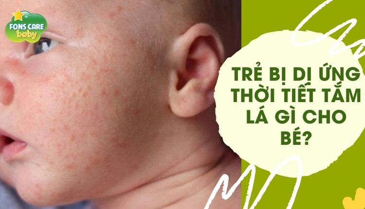 Trẻ bị dị ứng thời tiết, tắm lá gì cho bé nhanh khỏi?